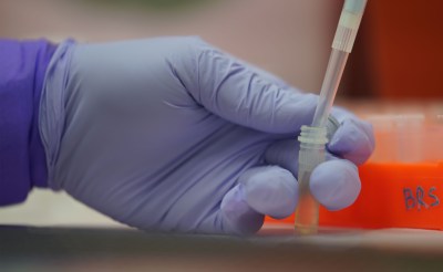 Demonstration of preparing nucleic acid for Polymerase Chain Reaction machine that will be used in Coronavirus lab testing/detection.
